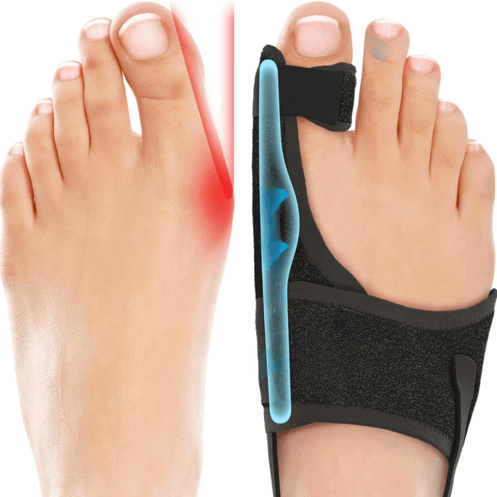 Adjustable Orthopedic Bunion Alignment Splint